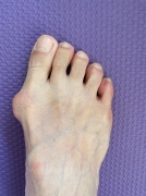 ϴ